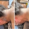 夏の肌見せに🪄パーツ脱毛3,300円【背中うなじ/両腕/両脚】※6回継続される方限定