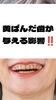 「黄ばみが与える印象、ホワイトニングで見直しませんか？」