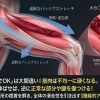 ストレッチは万能ではありません