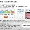 水の滞りに用いる漢方「五苓散」について