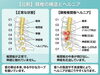 「なぜ首のヘルニアは治りにくい？整体師が教える「本当の原因」と正しい通い方」