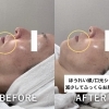 1回で口元が変わる！気になるほうれい線・シワをケアしてふっくらハリ肌へ★