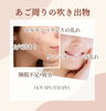あご周りの吹き出物改善「あご周りの吹き出物には」