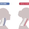 スマホ首？ストレートネック？首まわりの不調について