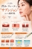 サブシジョン「ニキビ跡の凹み・クレーターに✨  長崎・サザクリでできる  “サブシジョン”という選択肢🫧」