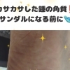 かかとの角質👣カサカサして悩んていませんか❓️❓️サンダル🩴に履き替える前に✨️大阪駅・梅田駅から2駅にある🚃足トラブルに特化したフットケアサロン👣野田阪神からすぐ🏡