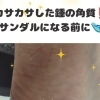 かかとの角質👣カサカサして悩んていませんか❓️❓️サンダル🩴に履き替える前に✨️大阪駅・梅田駅から2駅にある🚃足トラブルに特化したフットケアサロン👣野田阪神からすぐ🏡