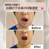 新潟市や県外からも選ばれる施術🤲　【新潟/村上市の小顔整体/小顔矯正/全身の歪みを整え戻りの少ない美小顔へ/姿勢改善/自律神経/整顔】