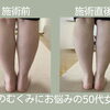 その足のだるさ放置しないで
