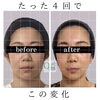 なりたい自分に近づく「たった4回でこの変化！フェイスラインのビフォーアフター」
