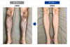 「メンズ脚脱毛ビフォーアフター｜8回施術後の変化をご紹介」