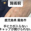 霧島市で手の症状でお困りの方へ