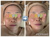 頬のツヤが眩しい！！透明感アップ！「マツヤニはツヤもハリもリフトアップも叶います。そしてむくみにもおすすめなんです！」