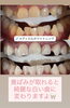 「黄ばみが取れると、こんなに白い歯に！メディカルホワイトニング症例」