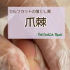 【爪棘】セルフカットの落とし罠⁈