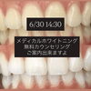 6/30（日）14:30〜 ホワイトニング無料カウンセリングご案内できます