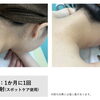 夏のアップヘアをもっときれいに見せる、うなじ・首元の脱毛ケア