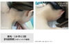 綺麗なお肌へ導く集中ケア「夏のアップヘアをもっときれいに見せる、うなじ・首元の脱毛ケア」