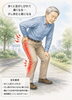 「脊柱管狭窄症」は、歩くと足がしびれて痛くなります。少し休むと楽になります。「「脊柱管狭窄症」」