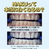 「本当に白くなるの？」「セルフって難しい？」にお答えします