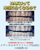 KIHAKU　未使用品　歯ホワイトニング機 本当に白くなるの？」「セルフって難しい？」にお答えします