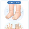 浮腫み（むくみ）でお悩みの方必見！　浮腫みは「水分の摂りすぎ」だけが原因ではありません！