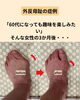 「【症例】3か月で外反母趾47°→23°へ｜草津市・60代女性」