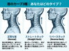「【10人に1人はすでに危険水域？】首の骨が逆方向に曲がる『リバースネック』の恐怖」