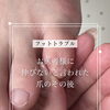 伸びないと言われた爪【福井/フットケア/足の爪】