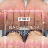 深爪から美爪へ【福井/自爪育成/爪悩み】