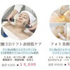 14周年キャンペーン先行予告＊「顔が違う！」と話題の3Dリフト