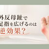 外反母趾で足指を広げるのは逆効果？
