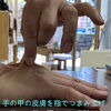 手の甲チェックで簡単セルフ脱水サイン確認♪