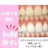 【10名さま限定】メディカルホワイトニング初回無料キャンペーン
