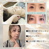 小顔だけじゃない？意外な変化もあるQpuの小顔矯正
