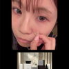 「シミケア＝レーザーしかない」と思っていませんか？  整体室BODYCAREろはす　江南市　扶桑町　大口町　犬山市　岩倉市