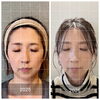 5ヶ月ほどでここまで変化！スタッフのビフォーアフター