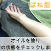 腱鞘炎が戻りやすい理由と通院の意味