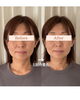 1回の変化で叶う小顔変化「重だるい浮腫み、スッキリさせませんか？」