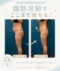 脂肪冷却「脂肪冷却大カップ1回でこんなに痩せます☺️💕」
