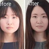 誰でも、いつからでも 小顔・美しいフェイスラインへ 若々しさを目指せます