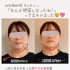 美容医療では難しい【左右差】を整えて立体的な垢抜け顔へ🪞