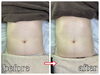 目指せ美 Body！確かな結果を実感「肋骨ケアでお腹スッキリ＊内側から“長く細い”ウエストラインへ」