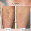 整体＋脱毛で「体もしんどさもムダ毛も」まとめてケア