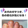 足の爪がデコボコしてる！爪の色がかわった！などの足トラブルはないですか❓️足トラブルに特化したフットケアサロン👣大阪駅・梅田駅から2駅にある個室サロン🏡野田阪神からすぐ🚃