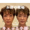 【空き枠わずか】今だけの特別価格で小顔に♩