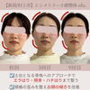 《面長・エラはりのお悩み》骨格でも遺伝でもない⁉️【新潟/村上市の小顔整体/小顔矯正/全身の歪みを整え戻りの少ない美小顔へ/姿勢改善/自律神経/整顔】