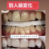 「別格変化!!」メディカルホワイトニングの症例をご紹介