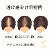 分け目の透け感が気になる方へ：スカルプインク無料カウンセリングのご案内