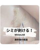 「シミが剥ける最新シミケア「WhiteLAB」の経過例」